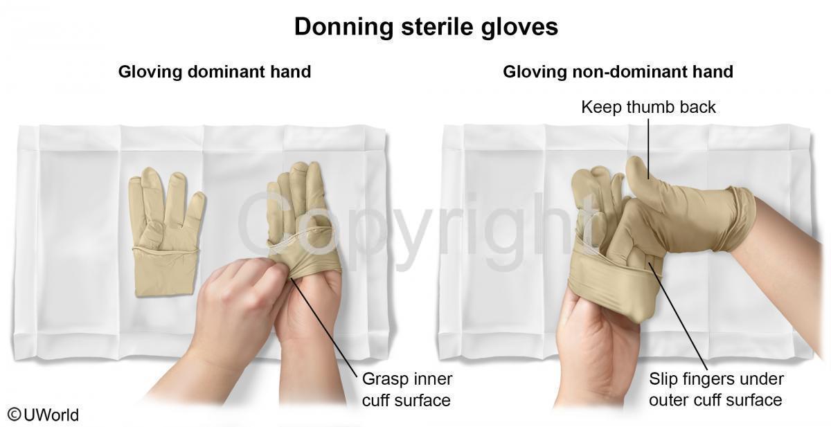 donning surgical gloves